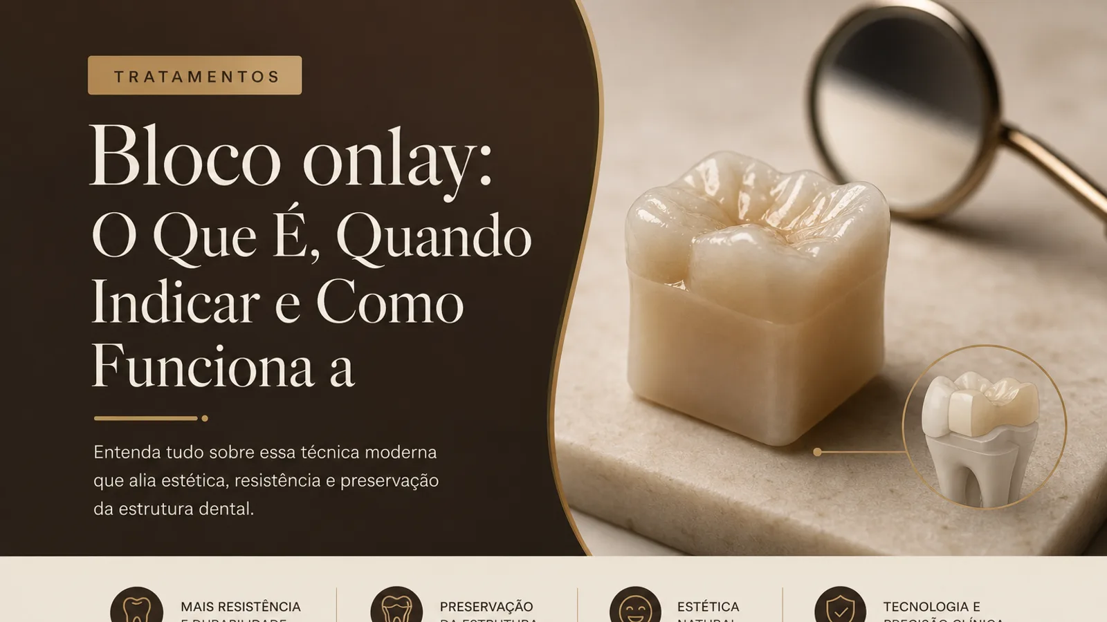 Bloco onlay: O Que É, Quando Indicar e Como Funciona a