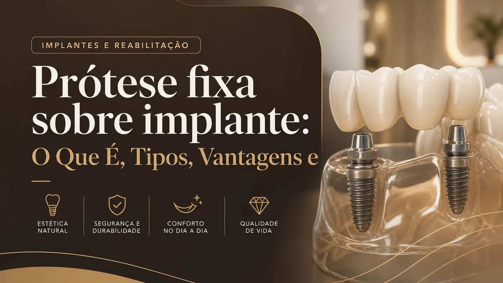 Prótese fixa sobre implante: O Que É, Tipos, Vantagens e