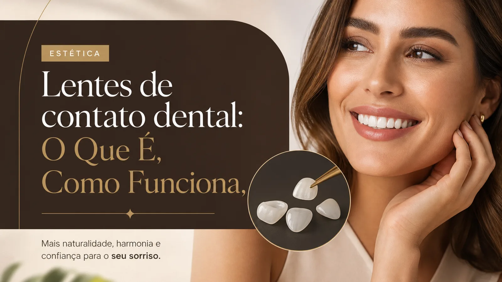 Lentes de contato dental: O Que É, Como Funciona,
