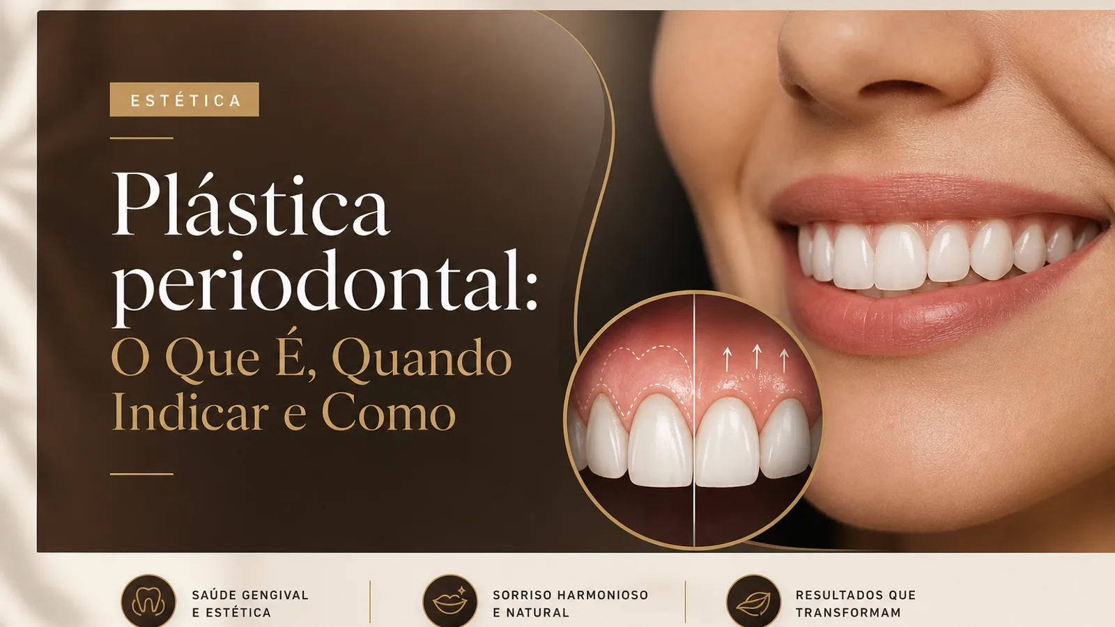 Plástica periodontal: O Que É, Quando Indicar e Como