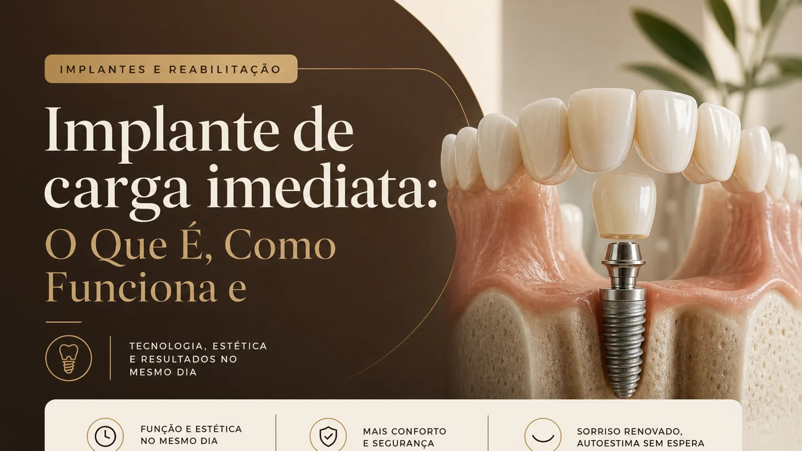 Implante de carga imediata: O Que É, Como Funciona e