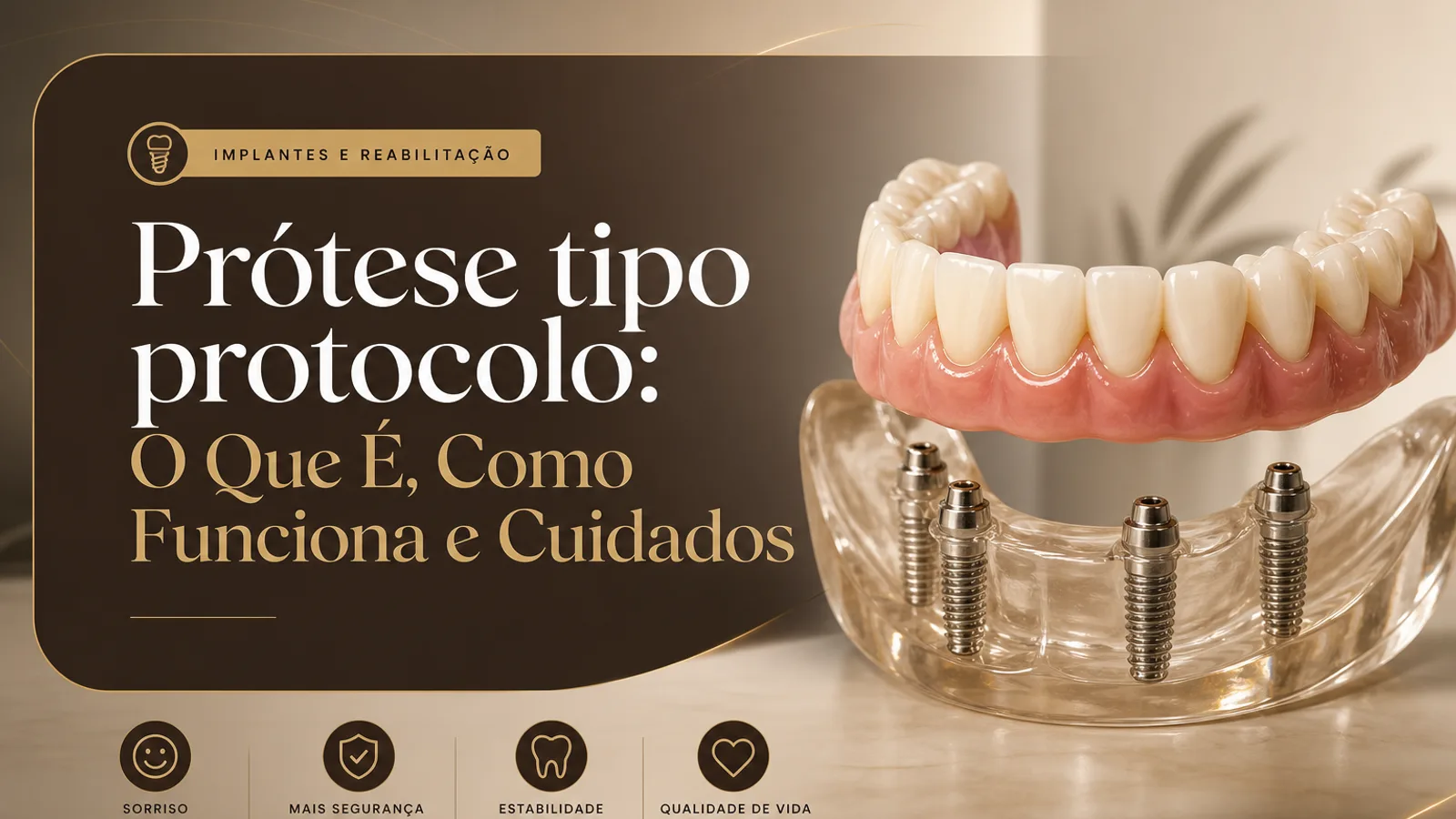 Prótese tipo protocolo: O Que É, Como Funciona e Cuidados