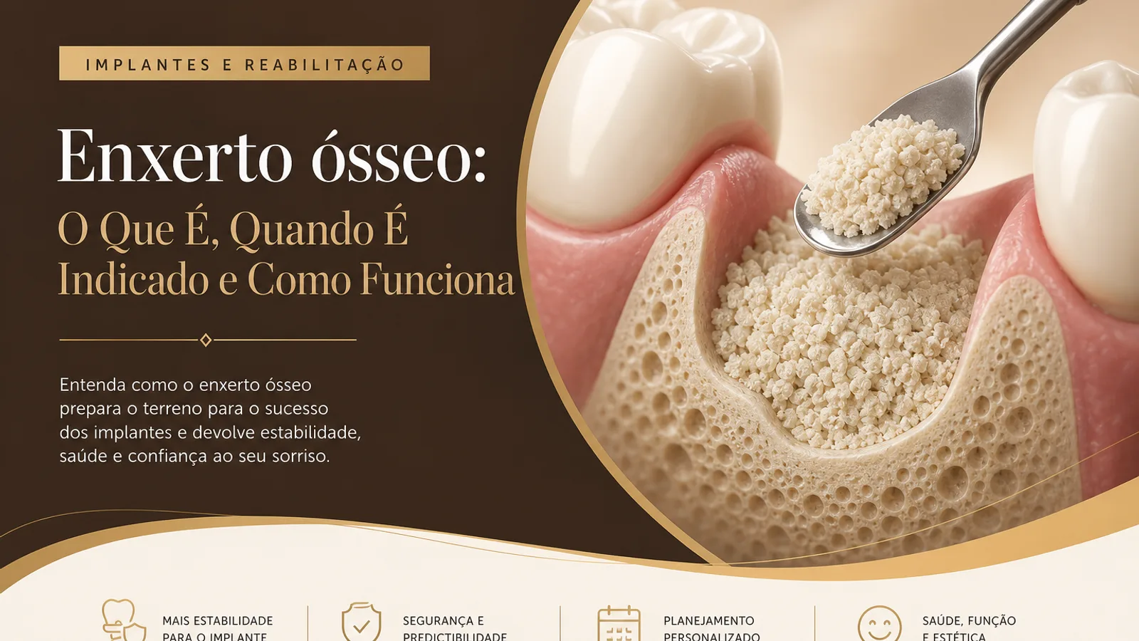 Enxerto ósseo: O Que É, Quando É Indicado e Como Funciona