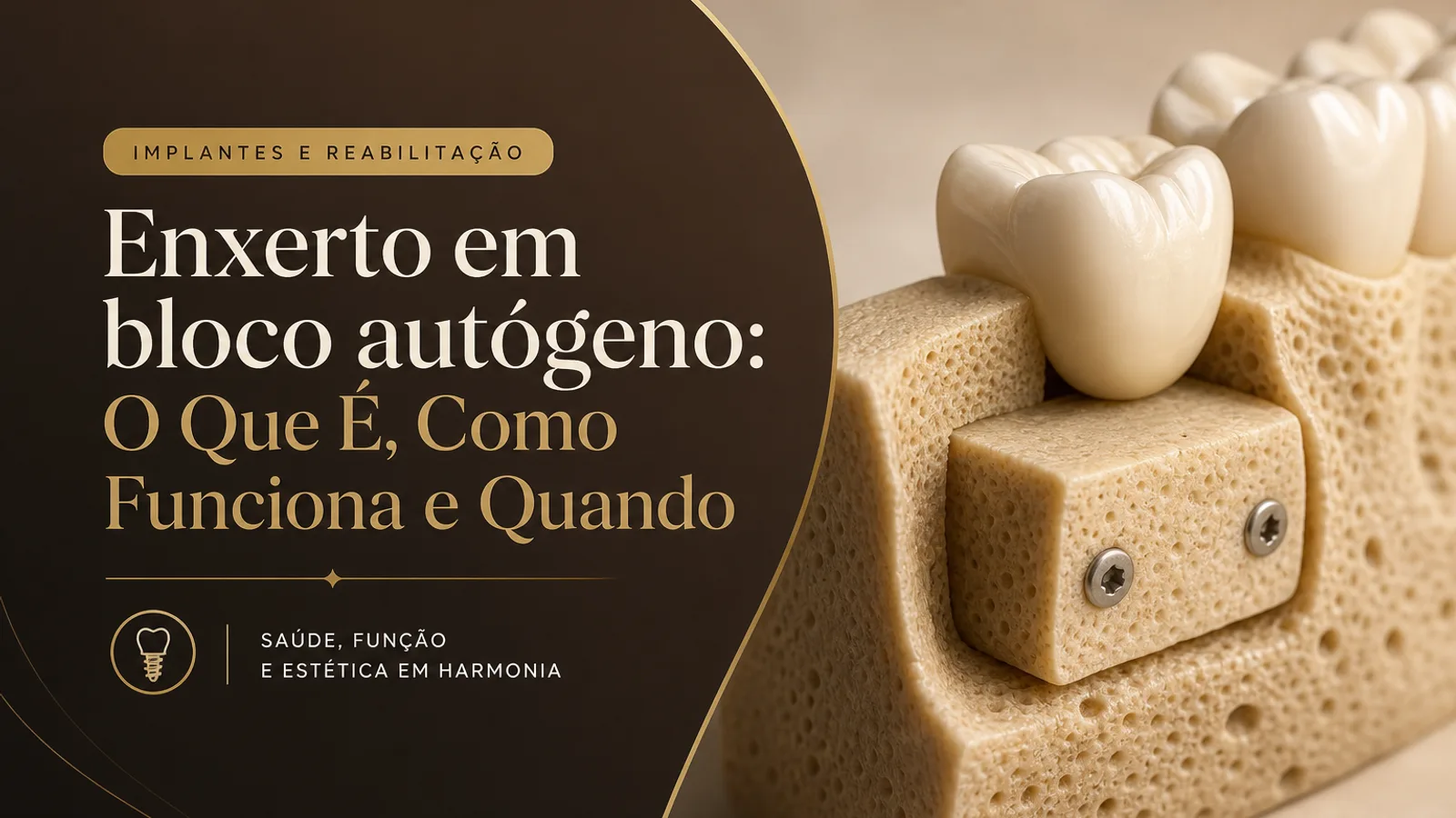 Enxerto em bloco autógeno: O Que É, Como Funciona e Quando