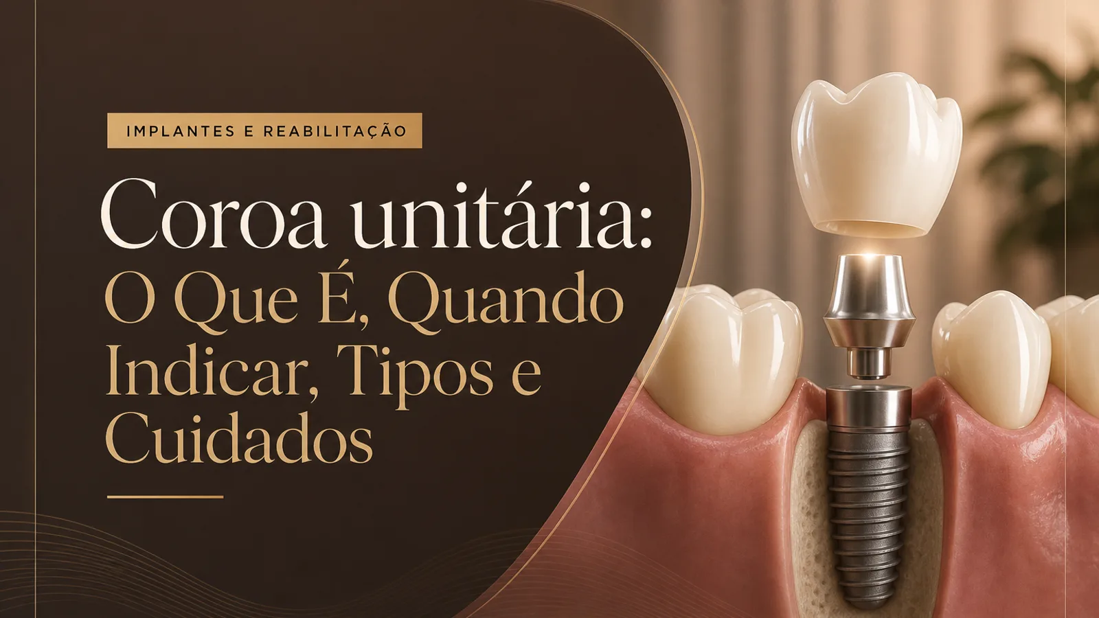 Coroa unitária: O Que É, Quando Indicar, Tipos e Cuidados