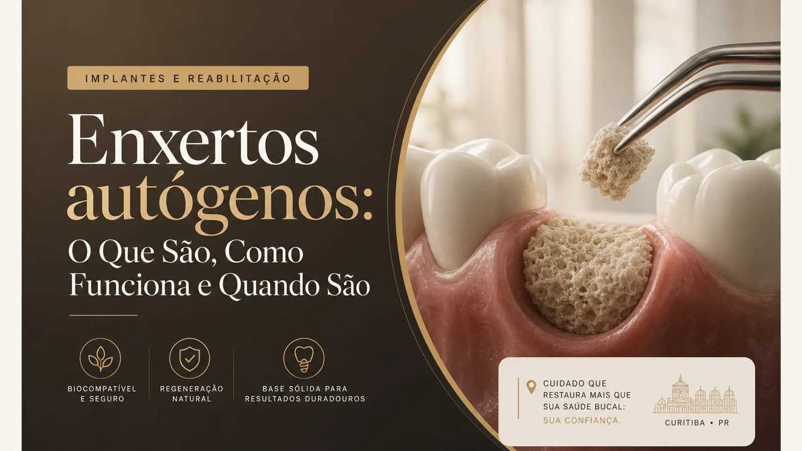 Enxertos autógenos: O Que São, Como Funciona e Quando São